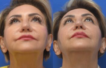 A collage of a woman's face.