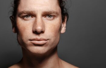 Portrait of a handsome long-haired man with drawn hair and freckles. Dark gray background